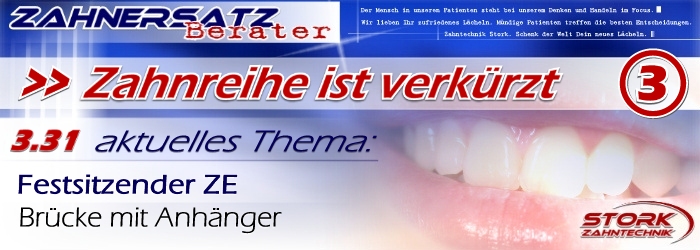 Eine Zahnreihe ist verkürzt